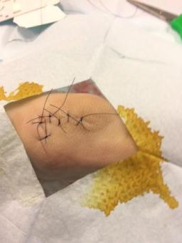 Notre première suture...